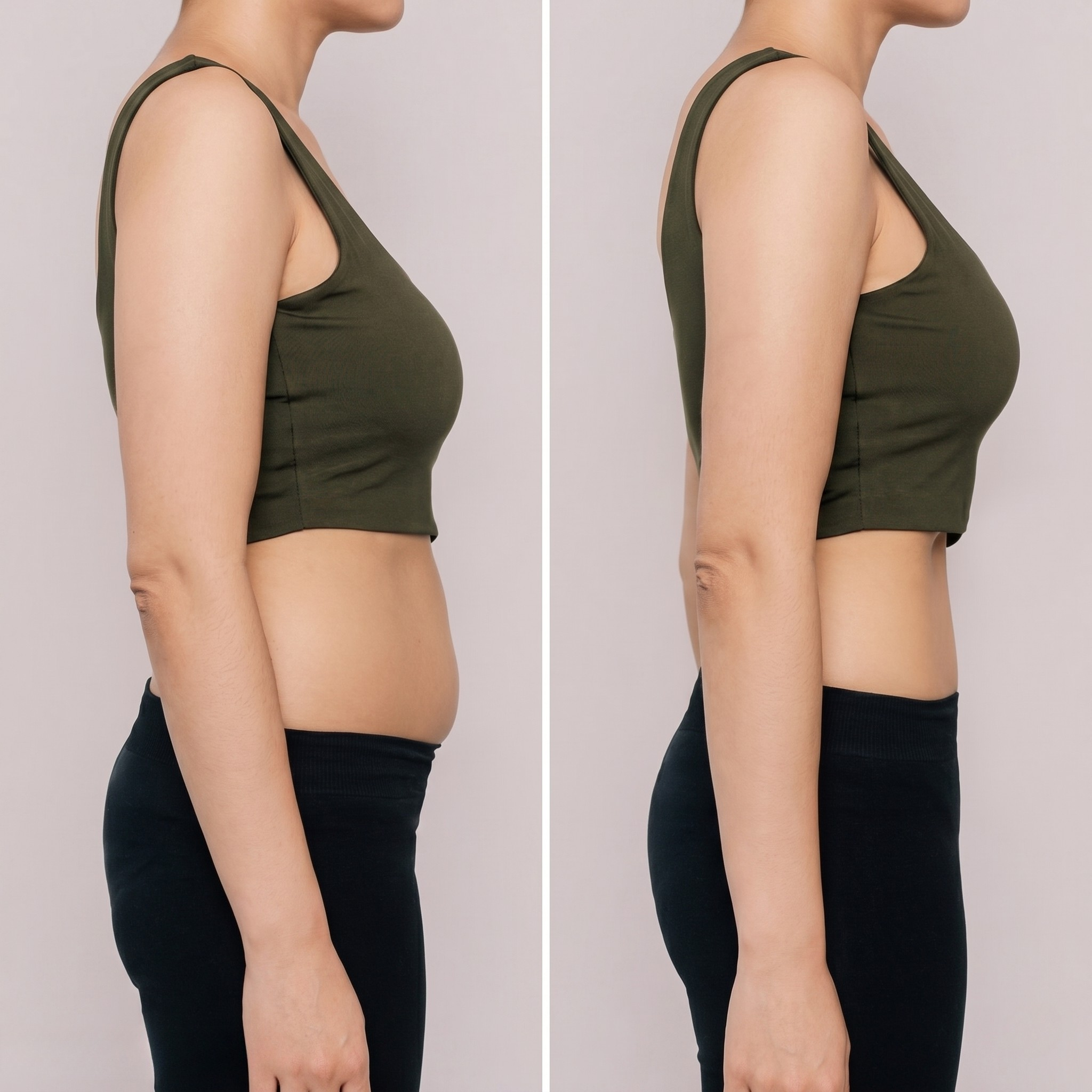 Before and after weight loss transformation